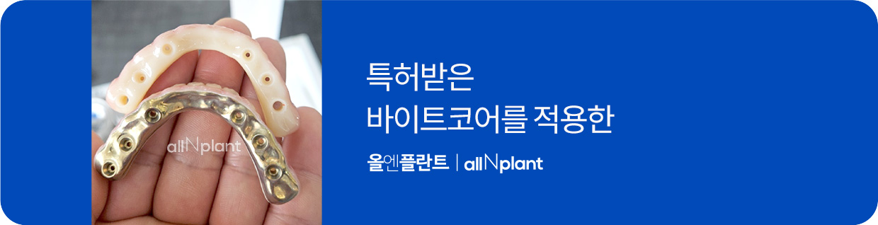 특허받은 바이트코어를 적용한