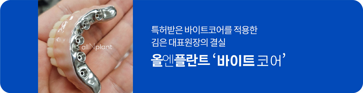 특허받은 바이트코어를 적용한 김은 대표원장의 결실 올엔플란트 ‘바이트코어’